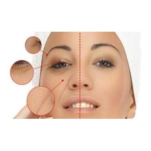 Agen Resmi Eye Lift Gel